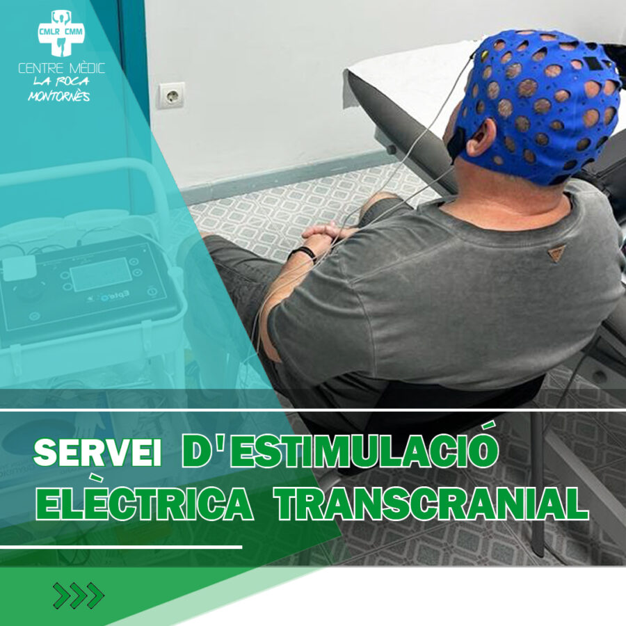 Estimulació elèctrica transcranial